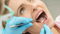 Fillings