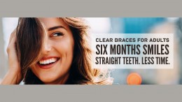 Six Month Smile