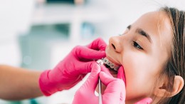 Children Braces