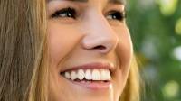 Invisalign Wimbledon