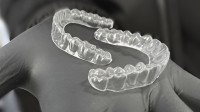 Clear Braces
